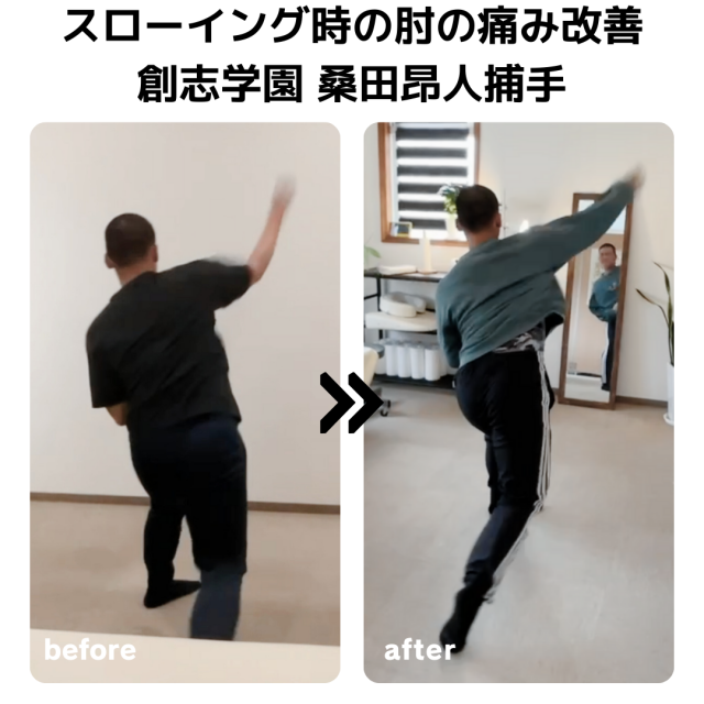 スローイング時の肘のズキっとした痛みの改善症例