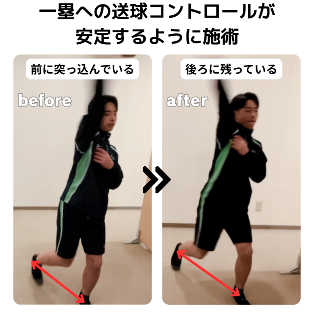 ショートの守備の送球が安定した症例