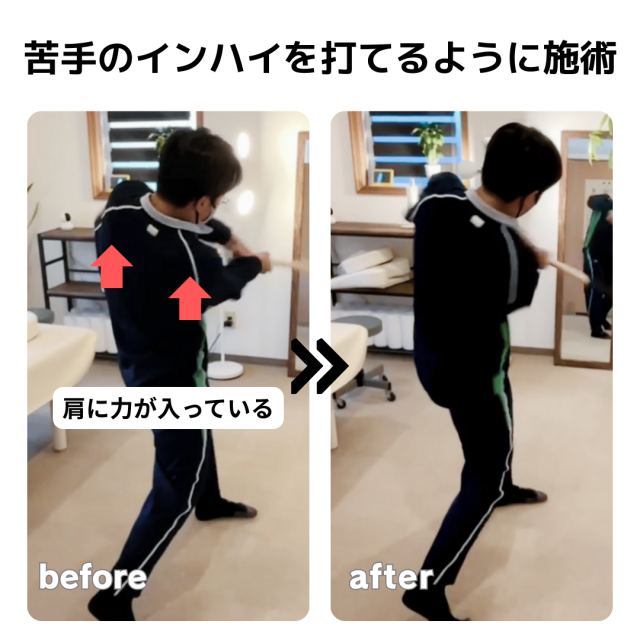 （バッティングフォーム最適化）苦手なインハイを打てるようになった症例