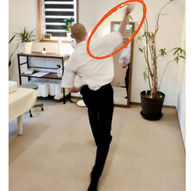 関節唇損傷・上腕骨骨頭の骨折/投球障害の症例